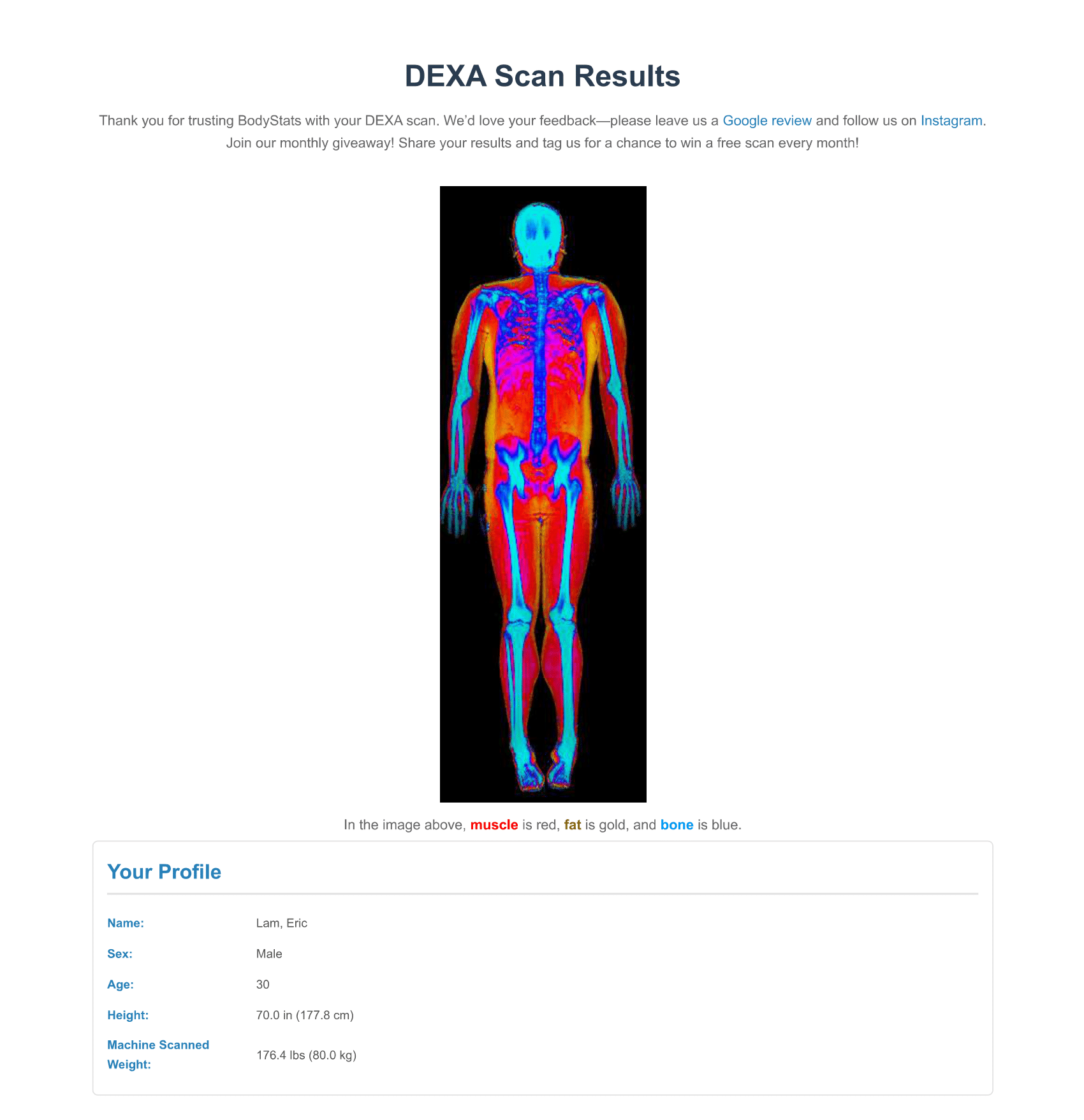 Sample Dexa Scan Report BodyStats
