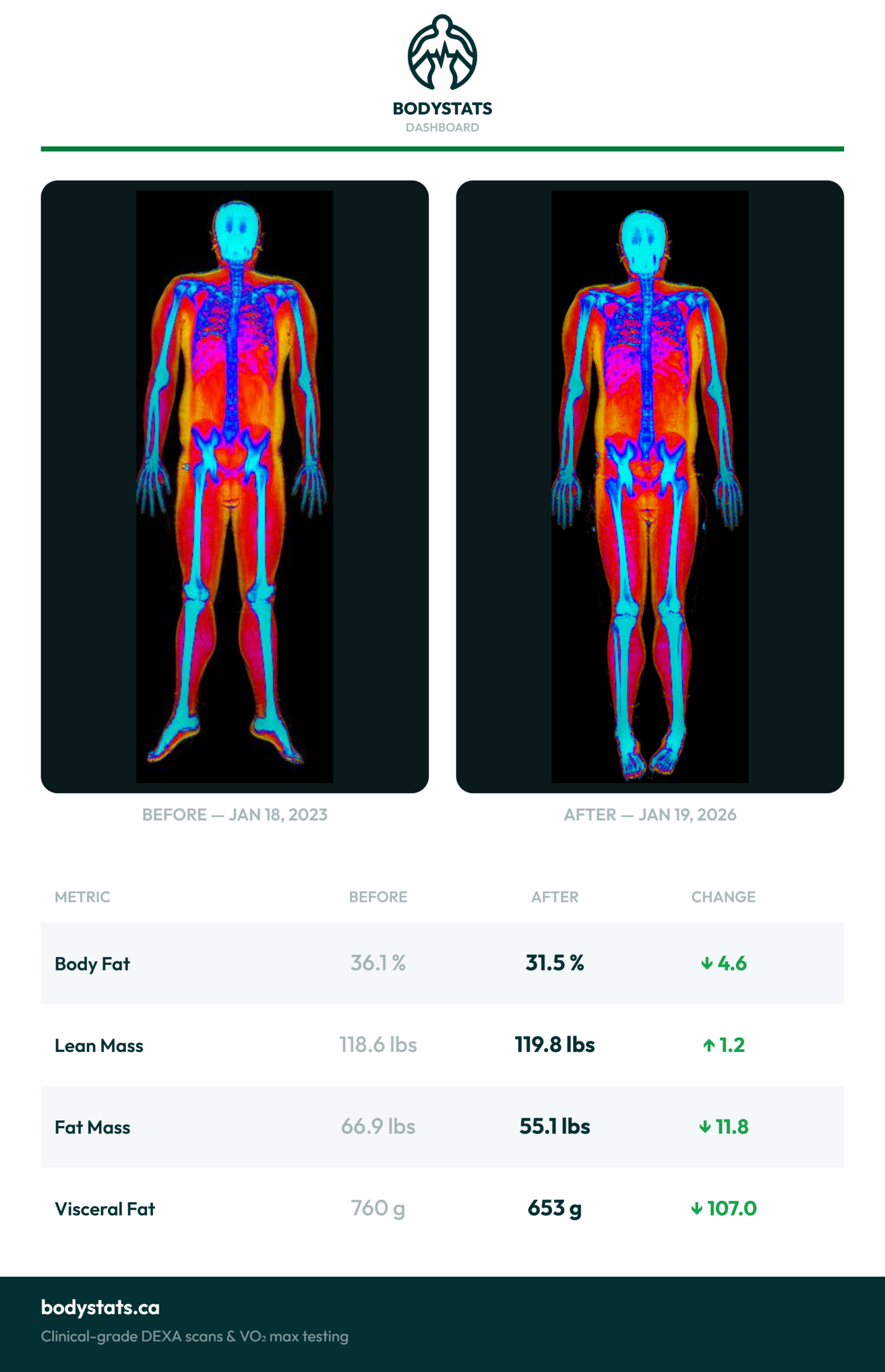 Before and after DEXA scan comparison showing body fat, lean mass, fat mass, and visceral fat changes