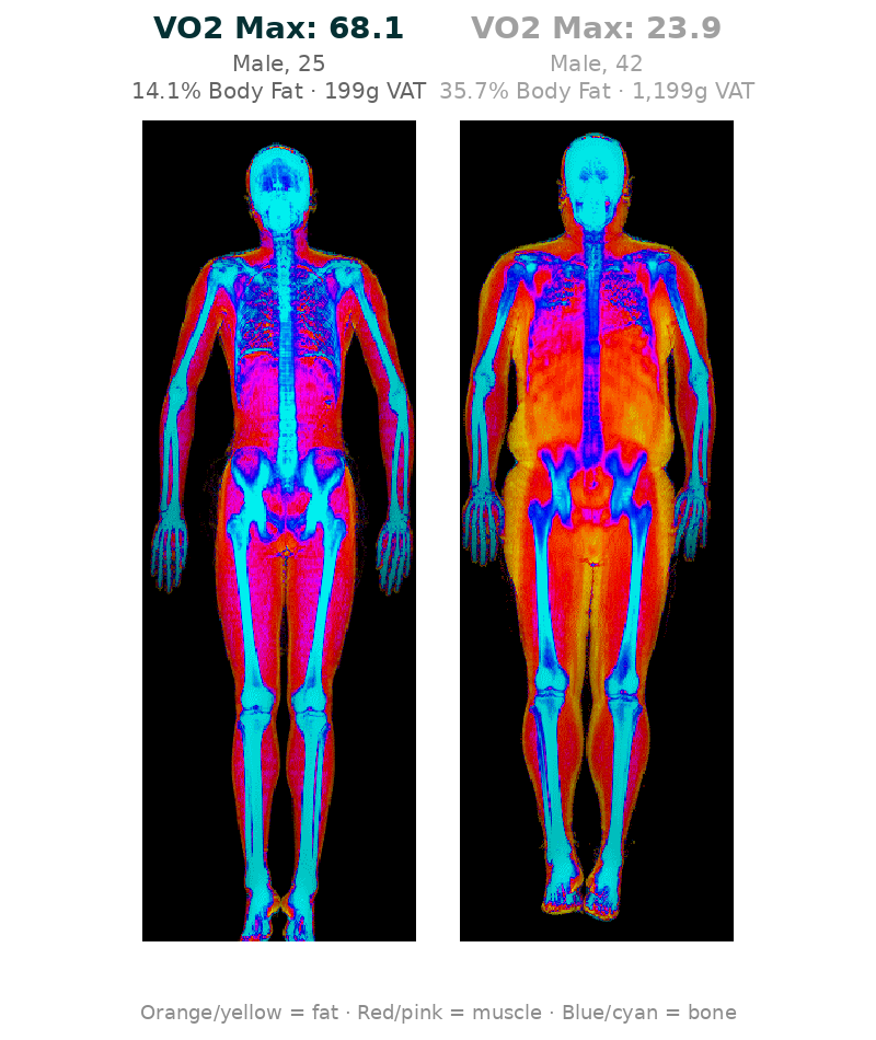 DEXA scan comparison: high VO2 max (14% body fat) vs low VO2 max (36% body fat)