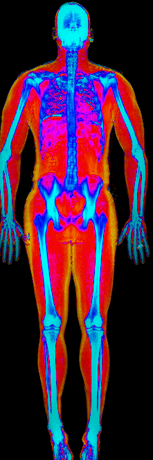 Eric DEXA body composition scan at 211 lb and 23.8 percent body fat showing muscle in red, fat in gold, and bone in blue