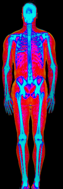 Esteban DEXA body composition scan at 222 lb and 17.1 percent body fat showing muscle in red fat in gold and bone in blue