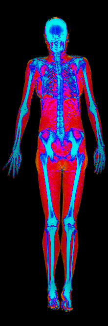 Female DEXA scan at 15.0% body fat