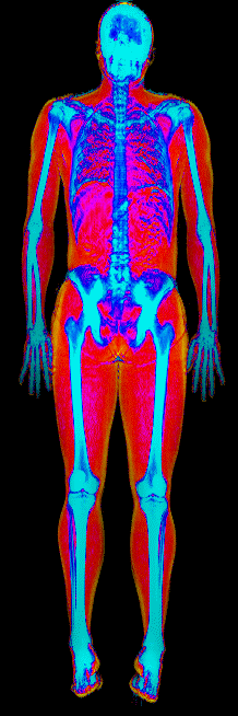Female DEXA scan at 18.8% body fat