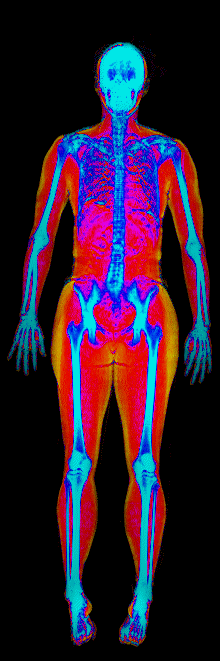 Female DEXA scan at 19.9% body fat