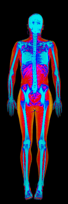 Female DEXA scan at 20.0% body fat