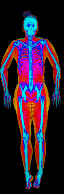 Female DEXA scan at 22.9% body fat