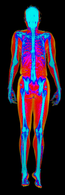 Female DEXA scan at 24.9% body fat