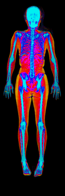 Female DEXA scan at 25.0% body fat