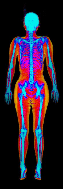 Female DEXA scan at 27.8% body fat
