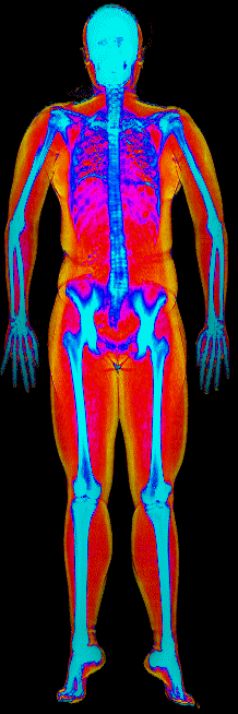 Female DEXA scan at 29.9% body fat