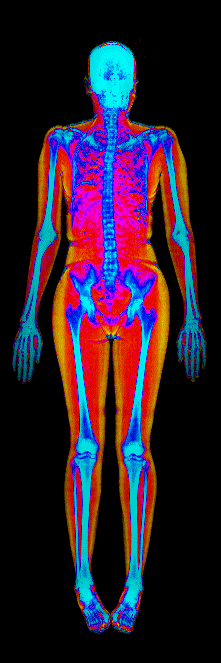 Female DEXA scan at 30.0% body fat