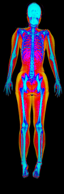 Female DEXA scan at 32.4% body fat