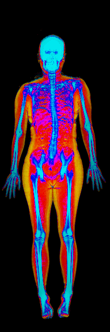 Female DEXA scan at 34.9% body fat