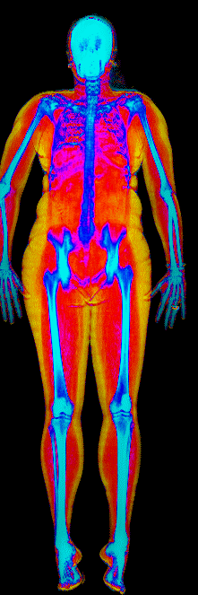Female DEXA scan at 35.0% body fat