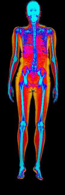 Female DEXA scan at 37.3% body fat