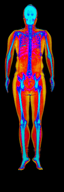 Female DEXA scan at 39.9% body fat