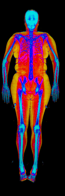 Female DEXA scan at 41.8% body fat