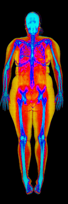 Female DEXA scan at 44.9% body fat