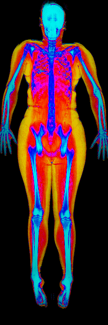 Female DEXA scan at 45.0% body fat