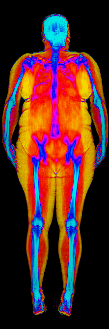 Female DEXA scan at 46.6% body fat