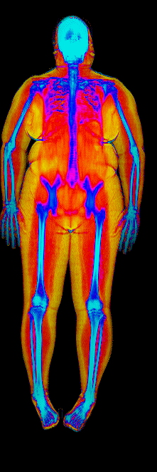 Female DEXA scan at 49.8% body fat