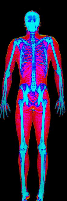 Male DEXA scan at 10.8% body fat