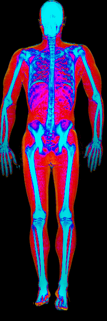 Male DEXA scan at 14.9% body fat