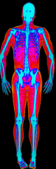 Male DEXA scan at 15.0% body fat