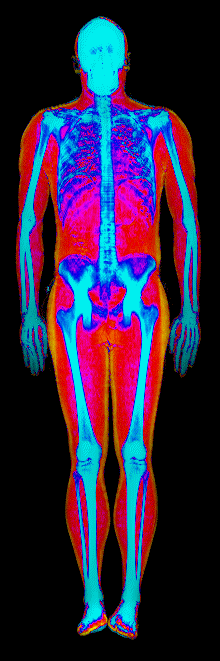 Male DEXA scan at 17.9% body fat