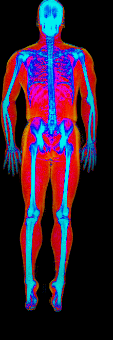 Male DEXA scan at 19.9% body fat