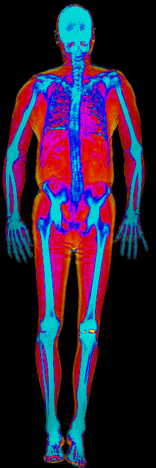 Male DEXA scan at 20.0% body fat