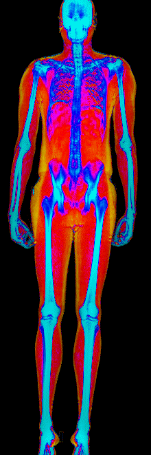 Male DEXA scan at 24.9% body fat