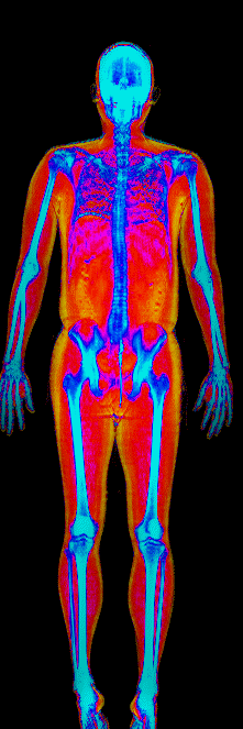 Male DEXA scan at 27.2% body fat