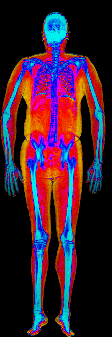 Male DEXA scan at 29.9% body fat