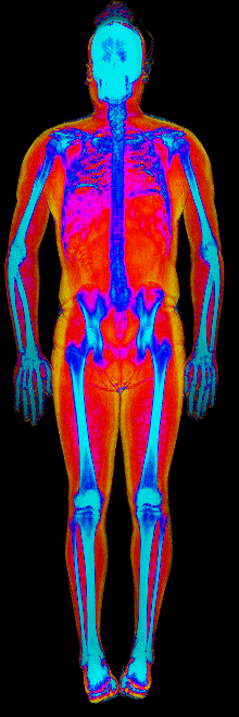 Male DEXA scan at 30.0% body fat