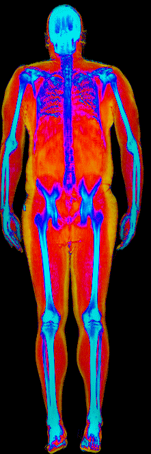 Male DEXA scan at 31.8% body fat