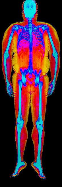 Male DEXA scan at 34.9% body fat