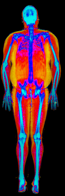 Male DEXA scan at 36.7% body fat
