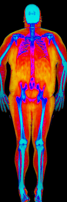 Male DEXA scan at 39.9% body fat