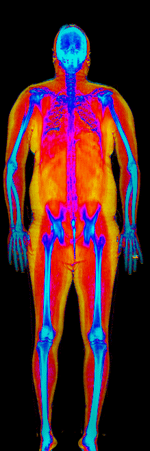 Male DEXA scan at 41.7% body fat