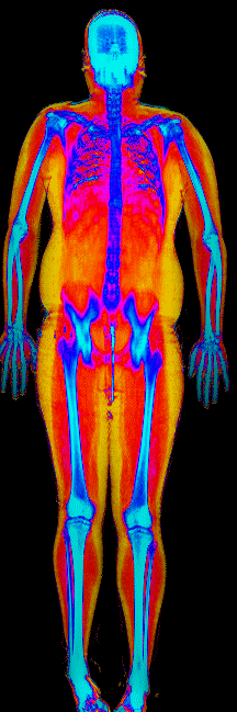 Male DEXA scan at 44.9% body fat