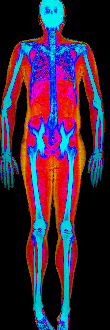 Male fat loss number 2 DEXA scan after at 191 lb