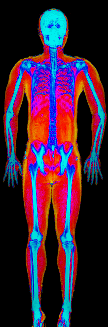 Male muscle gain number 3 DEXA scan after at 176 lb