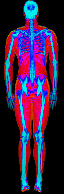 Brendan DEXA scan at 186 lb and 13.6 percent body fat in March 2026