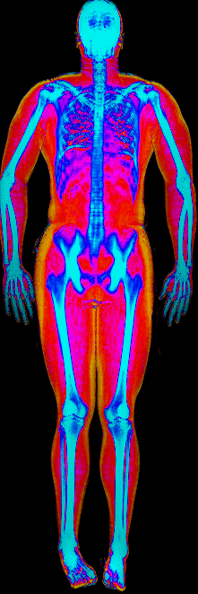 Brendan DEXA scan at 212 lb and 17.9 percent body fat in September 2025