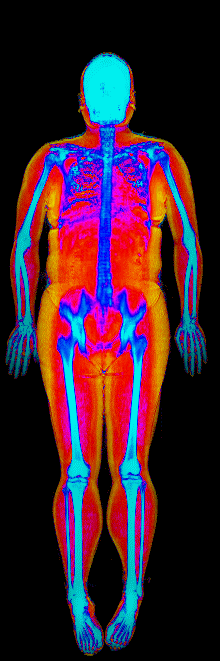 Female fat loss number 2 DEXA scan after at 180 lb and 29.9 percent body fat