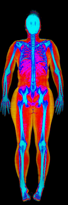 Female fat loss number 3 DEXA scan after at 170 lb and 28.9 percent body fat