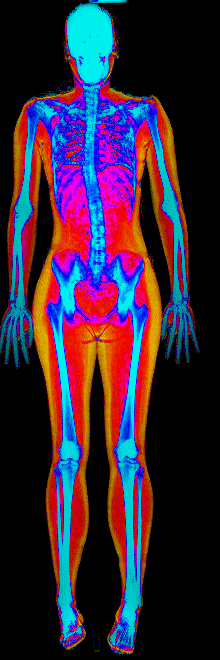 Female muscle gain number 3 DEXA scan after at 152 lb and 28.6 percent body fat