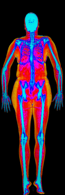 Kerstin DEXA body composition scan at 169 lb and 25.8 percent body fat after gaining 8.8 lb lean and losing 12.8 lb fat
