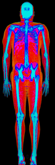Male fat loss number 1 DEXA scan after at 214 lb and 20.6 percent body fat